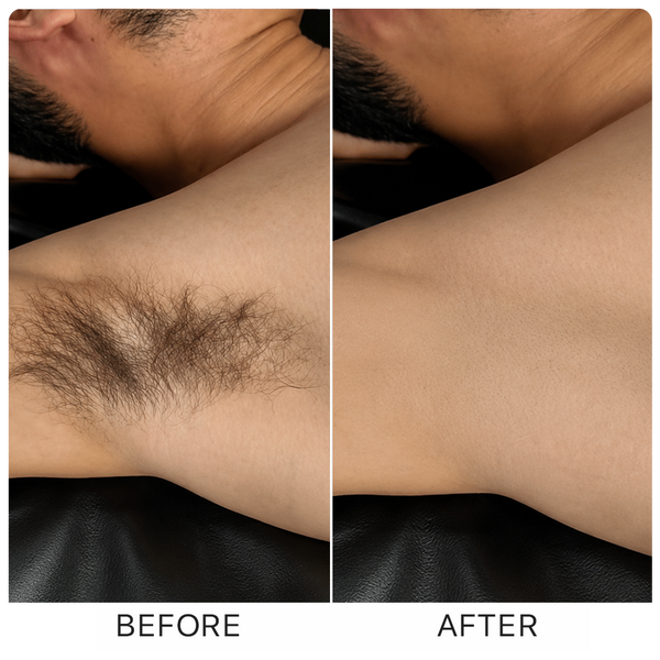 Before and after
