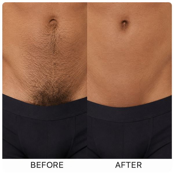 Before and after