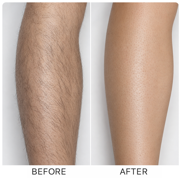 Before and after