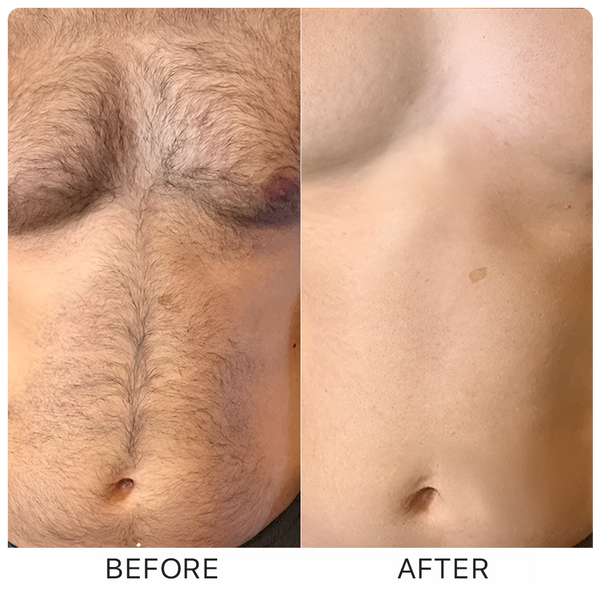 Before and after