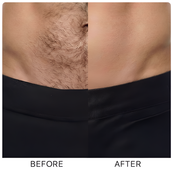 Before and after