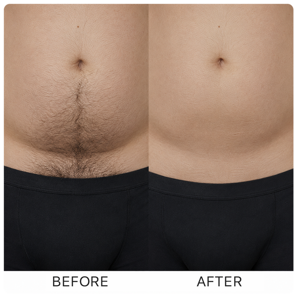 Before and after
