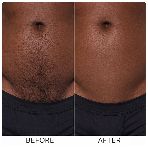 Before and after