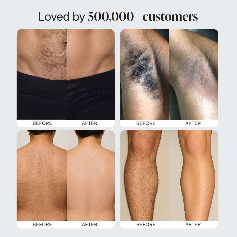 Dermave™ Electric Trimmer 2.0 for Men