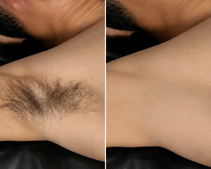 Carlos, 29